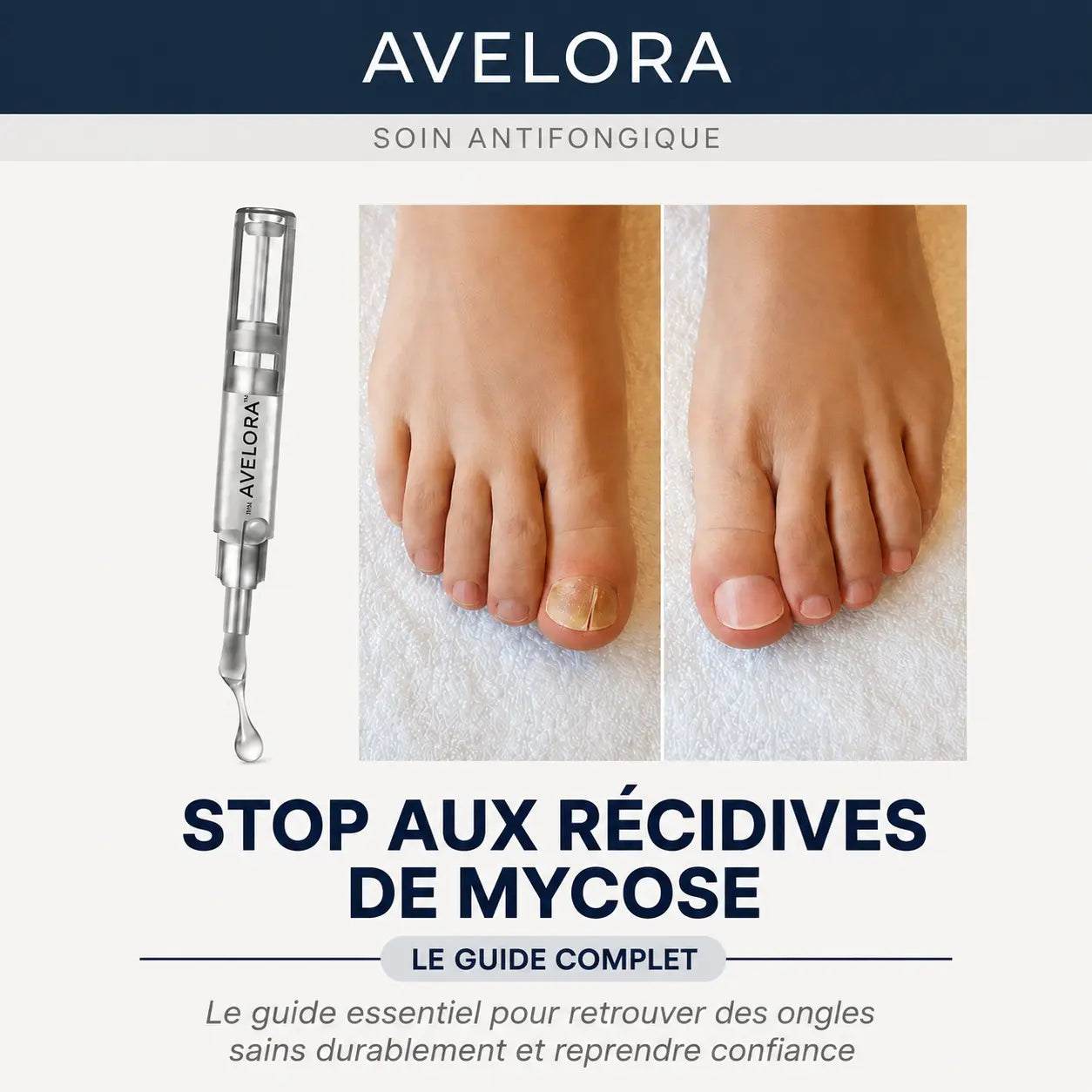 Guide complet anti mycoses